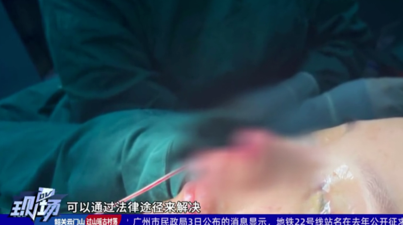女演员隆鼻事件上热搜，涉事医美机构公开回应